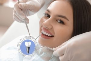 Woman smiles at camera with diagram of her implant.